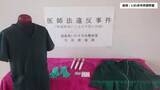 「無資格でイボ除去施術か　フィリピン国籍の女を逮捕＜福島県いわき市＞」の画像1