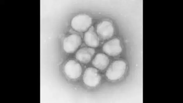 群馬県内で患者急増　インフルエンザ警報が発令