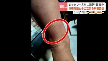 特定技能のミャンマー人らに暴行か 町議らを傷害容疑などで刑事告訴　20歳男性「怖かった、痛かった」町長は「できることは特にない」役場の不対応に懸念の声　北海道京極町
