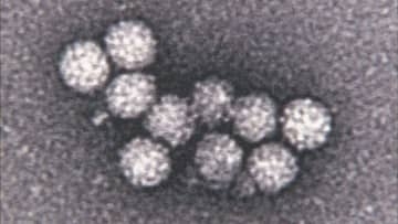 医療機関で患者と職員11人がおう吐や下痢など…4人の便からノロウイルス検出、感染性胃腸炎の集団発症か　北海道旭川市