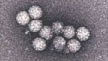 医療機関で患者と職員11人がおう吐や下痢など…8人の便からノロウイルス検出、感染性胃腸炎の集団発症か　北海道旭川市