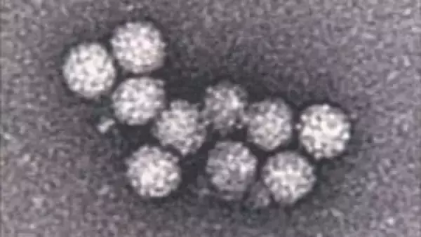 【ノロウイルス】園児ら30人が感染胃腸炎の集団発生　おう吐や下痢の症状相次ぐ　便からノロウイルス確認