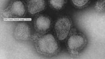 【過去10年間で最悪】インフル道内で猛威　定点医療機関の報告数61.78人…函館119.40人、釧路103.22人《各保健所別の報告数一覧（11月17日～23日》