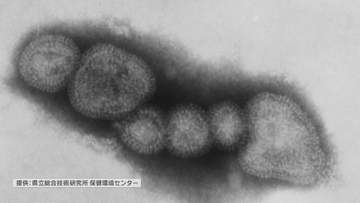 インフルエンザ　広島市も流行入り　去年より７週早く