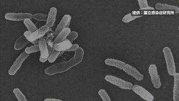 釧路市阿寒町の温泉施設、基準値超えのレジオネラ菌検出で営業休止に　営業再開に向け清掃と再検査へ