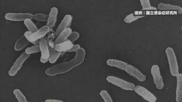釧路市阿寒町の温泉施設、基準値超えのレジオネラ菌検出で営業休止に　営業再開に向け清掃と再検査へ