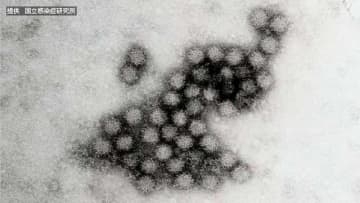 旭川市の保育園でノロウイルス集団感染　14人が嘔吐や下痢