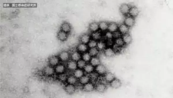 旭川市の保育園でノロウイルス集団感染　14人が嘔吐や下痢