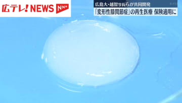 変形性膝関節症向け治療が今月から保険適用に　広島大学長らが開発の再生医療製品