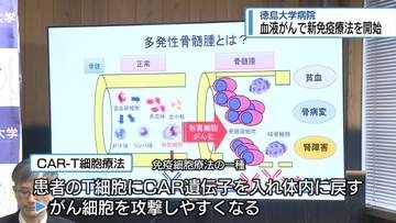 血液がんの「新しい免疫療法」開始　徳島大学【徳島】