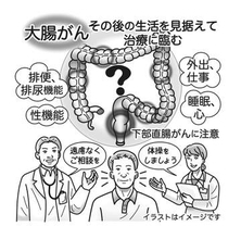 気になる症状　すっきり診断（222）大腸がん手術後、生活の質は？　変化知り、納得の治療を