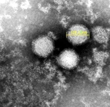 マダニ媒介のウイルス感染症「SFTS」 宮城で患者を初確認　90代男性が発症し入院中