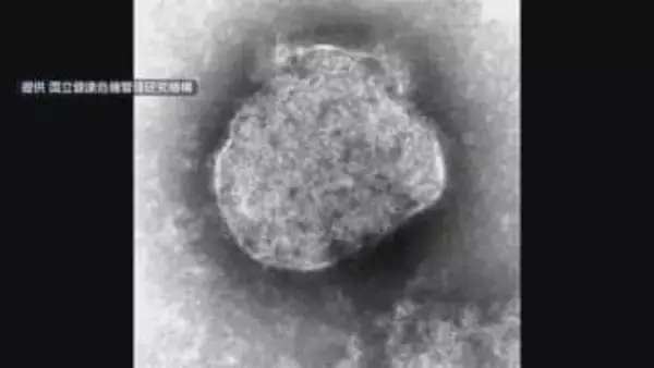 福岡県で今年初のはしか感染者を確認　感染力極めて強く県が注意を呼びかけ