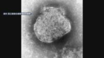 福岡県で今年初のはしか感染者を確認　感染力極めて強く県が注意を呼びかけ