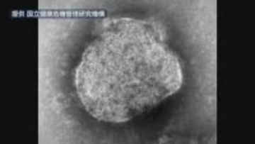 はしか感染　県内で今年２人目