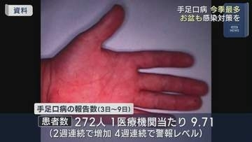 手足口病は依然警報レベル