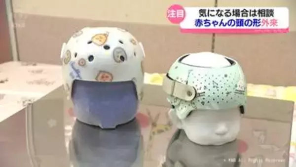 気になる！？赤ちゃんの頭の形外来　県立中央病院にも先月開設