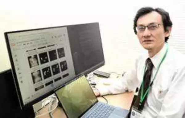 便秘の種類、AIで正しく判別　兵庫県立大研究所などが新技術「早期治療が可能に」