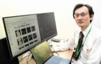 便秘の種類、AIで正しく判別　兵庫県立大研究所などが新技術「早期治療が可能に」