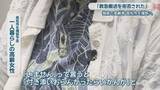 「「同乗者がいないことを理由に救急搬送を拒否された」　一人暮らしの高齢者　高松市を提訴へ」の画像1