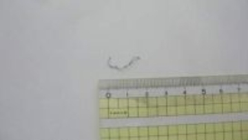 給食の「鶏の唐揚げ」に約2cmの糸状の金属片　児童に健康被害なし　香川・三豊市