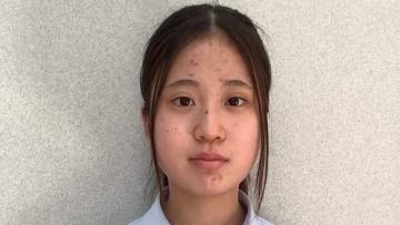 壷井栄賞に小豆島中3年の松下侑愛さん　香川