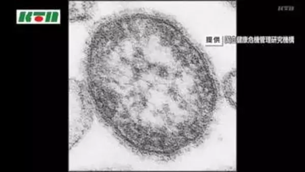 麻しん（はしか）の患者発生　全国的に感染者数が増加　頭痛や倦怠感などの症状　長崎市内2例目