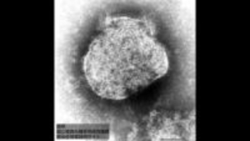 麻しん（はしか）患者高知県内で確認　高知県内での発生は2008年以来「免疫をつけるため予防接種を受けることが最も効果的」