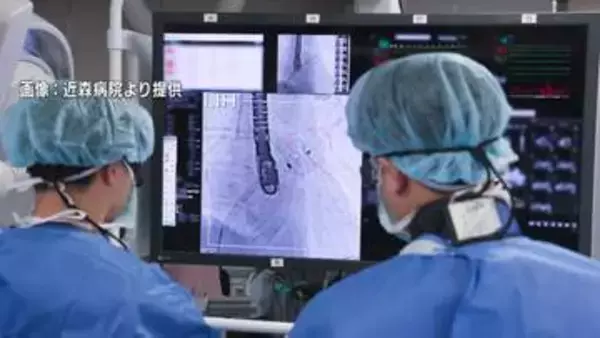 【四国初】脳梗塞の“火種”を封じる「心臓のお守り」近森病院が最新機器アミュレット導入「アクセス悪い高知でも医療完結を」【高知】