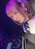 「酔って転んでアザだらけ　ネイルも折れて超悲惨　ケガが絶えない夜のお仕事　「病院代」と数万円を渡す神客も！【現役キャストに取材】」の画像1