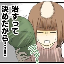 髪のない頭部を男性に見せるなんて…　13年間抜毛症に悩む女性が専門カウンセリングへ　寛解した作者が伝えたいこと【漫画】