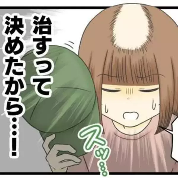 髪のない頭部を男性に見せるなんて…　13年間抜毛症に悩む女性が専門カウンセリングへ　寛解した作者が伝えたいこと【漫画】