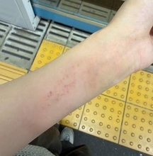 「名誉の負傷だわ！」駅トイレの中から「誰か助けて」とSOS、扉も開けられず…　ある女性の、わが身をかえりみない救出エピソードが話題に