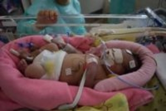 不妊治療6年、40代で授かった娘は「運動に障害が出るかも」　ところが……“奇跡の成長”に感動の声