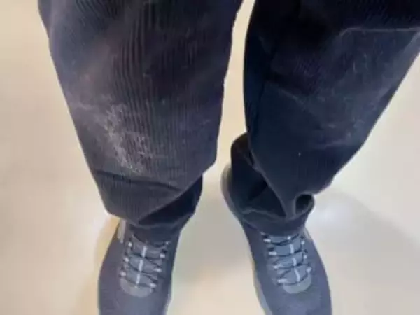 こんなに抜けるの！？「膝に柴犬を受けてしまってな…」朝散歩で起きた“毛だらけハプニング”に「柴あるある」「うらやましい」の声殺到