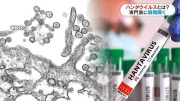 クルーズ船で相次ぐ“ハンタウイルス”とは？「ヒトヒト感染は？」「パンデミックになる？」専門家に聞いた