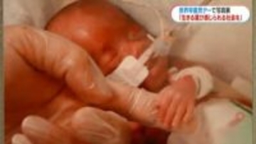 小さな命に「力もらえる」早産児や家族への理解を…世界早産児デー写真展