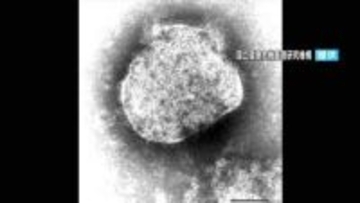 GW中に感染拡大のおそれ　統計開始以来最多「はしか」感染防止呼びかけ　鹿児島