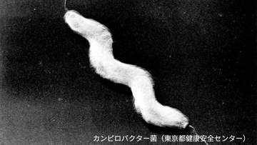 カンピロバクターで14人が食中毒　下痢や腹痛、発熱などの症状　飲食店に5日間の営業停止処分　鹿児島