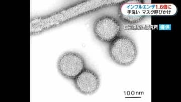 インフルエンザ感染者　前週の1.6倍　手洗いの徹底やマスク着用を呼びかけ