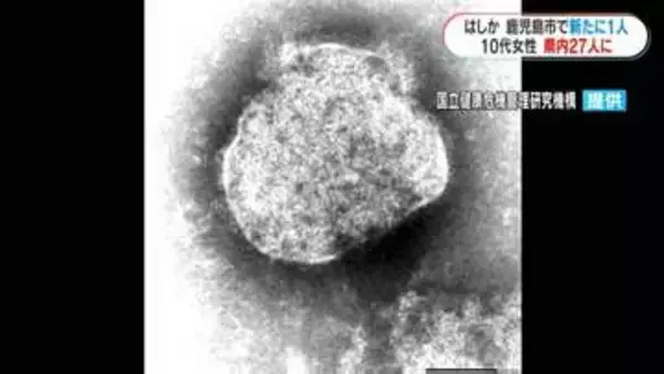 10代女性“はしか”感染　鹿児島市のファストフード店やアニメショップを利用　今年の県内感染者27人で過去最多
