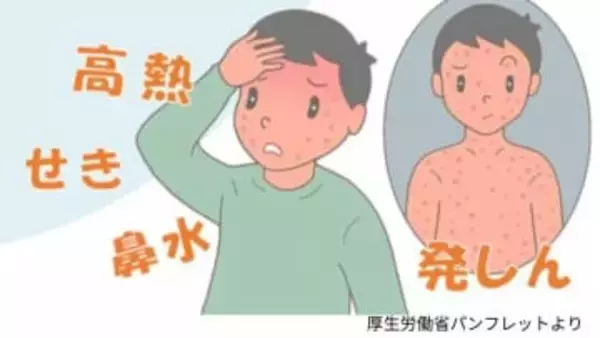 「はしか」患者　県内で3人感染確認　鹿児島県が注意呼びかけ【はしかの注意点と予防方法】