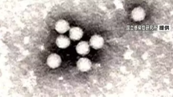2年ぶりに手足口病流行発生警報「手洗いをしっかり」鹿児島県