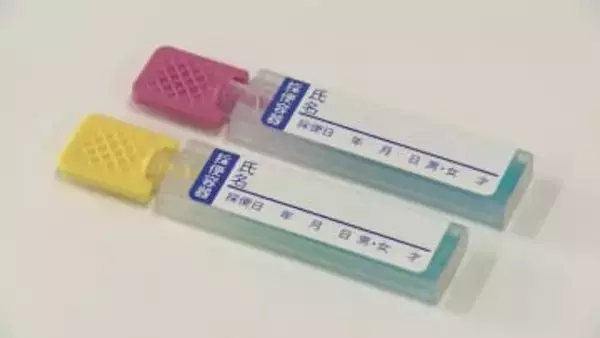 大腸がん検査を手軽に　検診キットを盛岡市内のスーパーで販売　岩手県