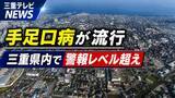 「手足口病が流行　三重県内で警報レベル超え」の画像1