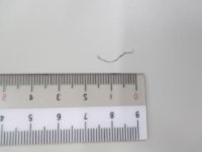 給食に1.5センチの金属片　小学校で異物混入