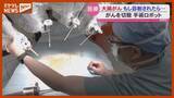 「「早期発見できればほぼ100％近く治る病気」大腸がん 初期症状と最新手術＜宮城・仙台市＞」の画像1