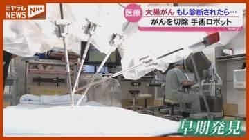 【特集】がん患者数が最も多い「大腸がん」　見逃しやすい初期症状とは？＜東北大学病院＞