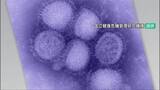 「インフルエンザ感染拡大止まらず 石川県内1581人、県内全体9週ぶりの警報発令・金沢市中心に」の画像1