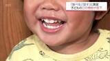 「お口がぽかん  子どもの口腔機能発達不全症が全国で増加 昔ながらの遊び減少も原因に」の画像1